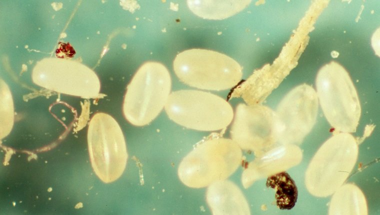 MUNICH, GERMANY - NOVEMBER 26: Flea eggs in the institute for parasitology of the Ludwig-Maximilians-University Munich on November 26, 2003 in Munich, Germany. (Photo by Agency-Animal-Picture/Getty Images)