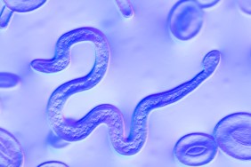 parasite